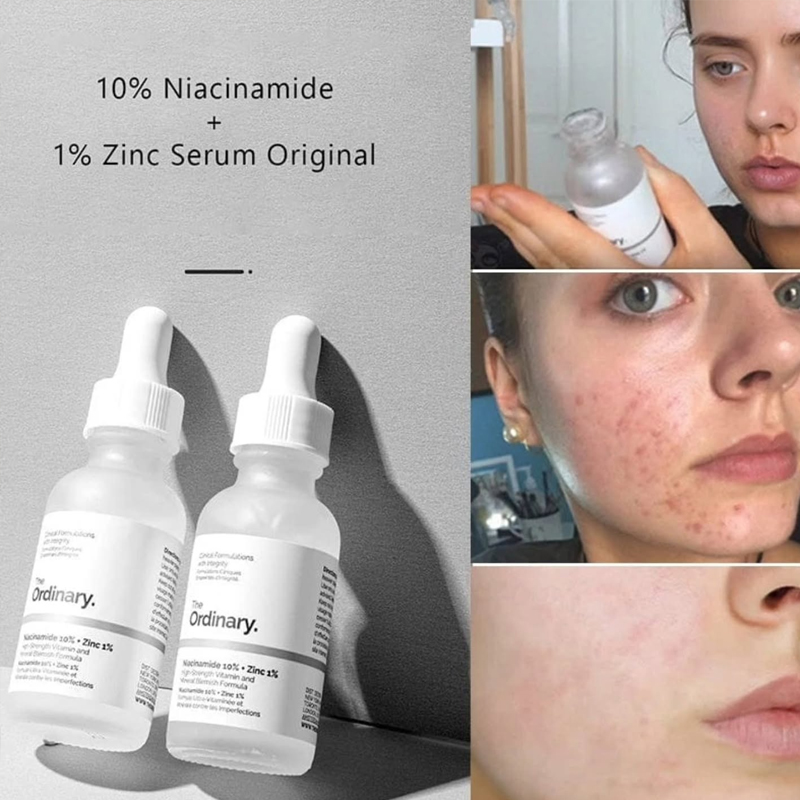 Сыворотка The Ordinary с ниаци – обзор и цена Luxury Skincare Brands